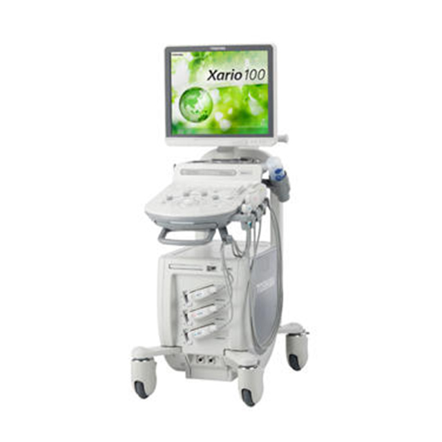 超音波診断装置