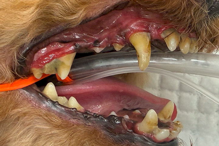 処置前の歯の状態