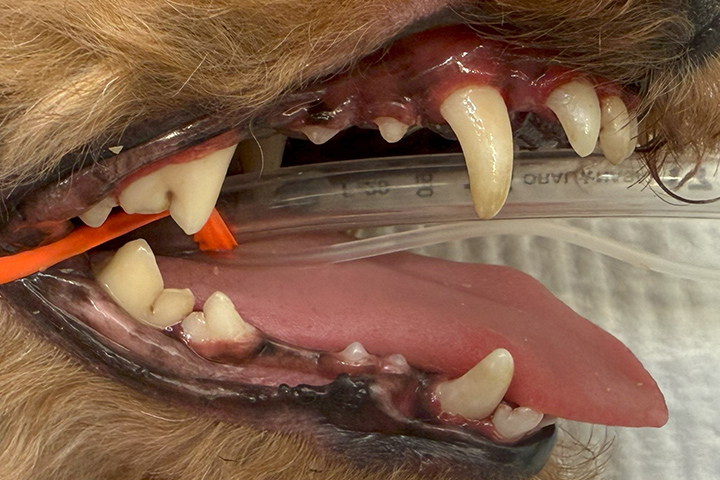 処置後の歯の状態