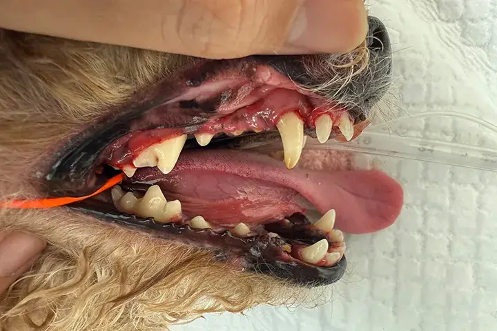 処置後の歯の状態